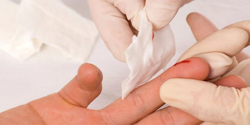 Nằm mơ thấy đứt tay và luận giải về các ý nghĩa xung quanh