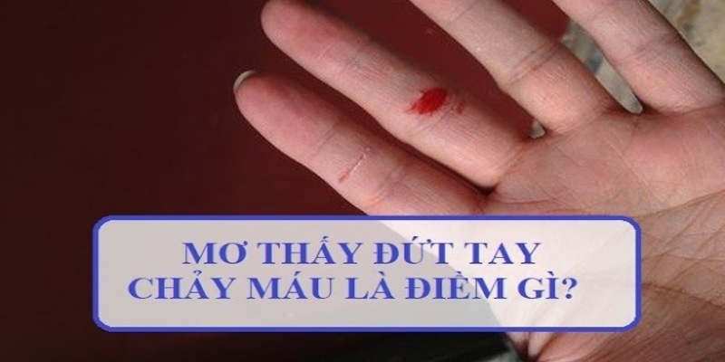 Ý nghĩa thực sự về việc nằm mơ thấy đứt tay theo chuyên gia